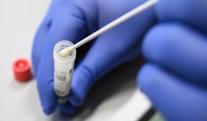 Лабораторно підтверджено 220 нових випадків COVID-19 в області