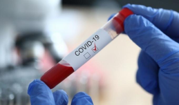 На Луганщині лабораторно підтверджено 12 нових випадків COVID-19 