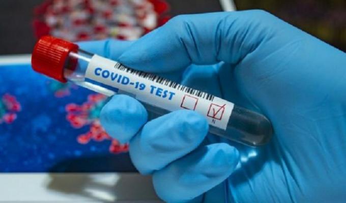 На Луганщині зафіксовано шість нових випадків COVID-19