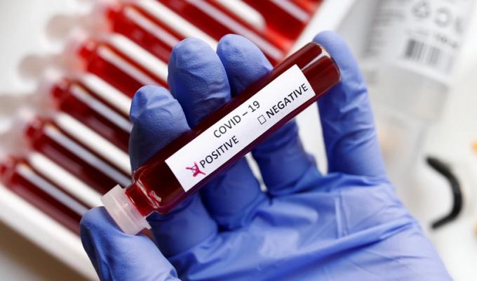 Лабораторно підтверджено 43 нових випадків COVID-19 в області