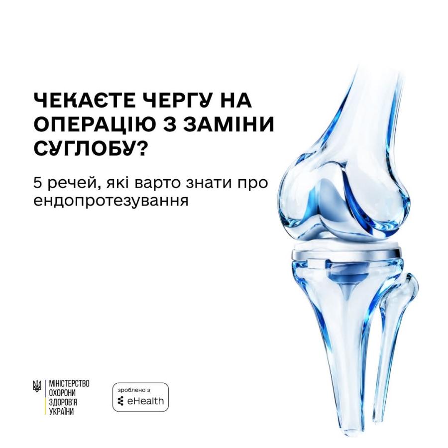 В Україні безоплатне ендопротезування можна отримати в медичних закладах, які мають відповідний договір з НСЗУ