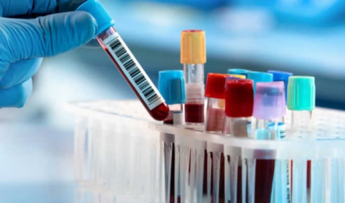 На Луганщині лабораторно підтверджено 263 нових випадки COVID-19