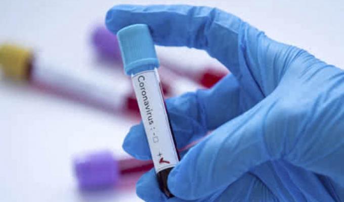 На Луганщині зафіксовано 99 нових випадків захворювання на COVID-19