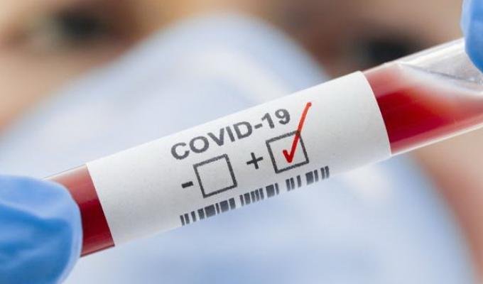 За добу в області зафіксовано 36 нових випадків COVID-19 