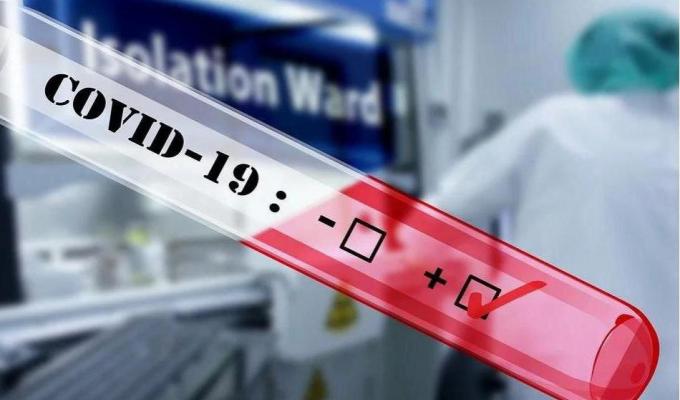 Лабораторно підтверджено 5 нових випадків COVID-19 в області 