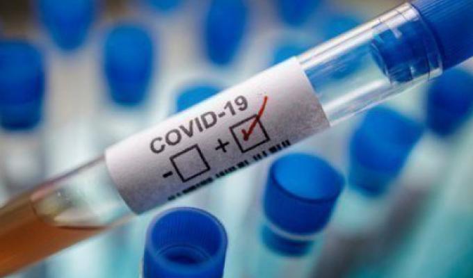 В області зафіксовано шість нових випадків захворювання на COVID-19