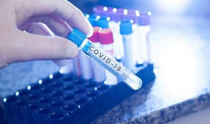 Лабораторно підтверджено 54 нових випадки COVID-19 в області