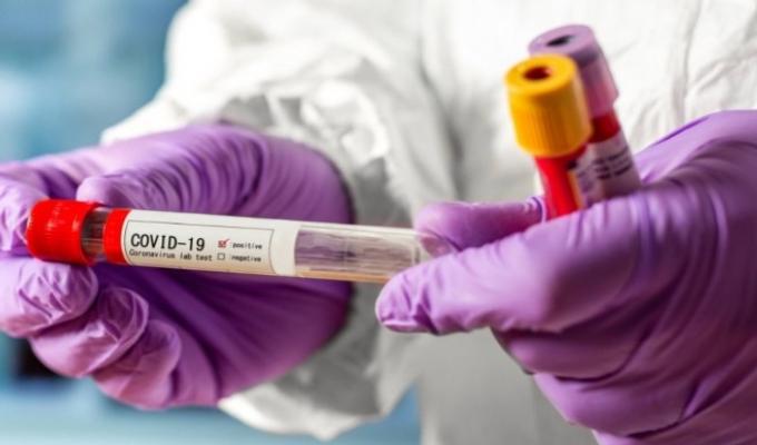 В області ще дві людини захворіли на COVID-19