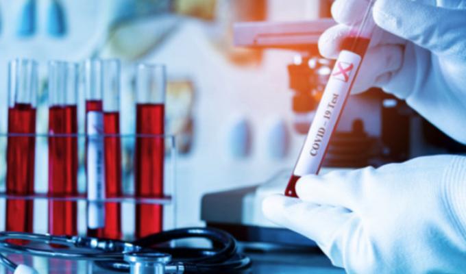 Лабораторно підтверджено 27 нових випадків COVID-19 в області 