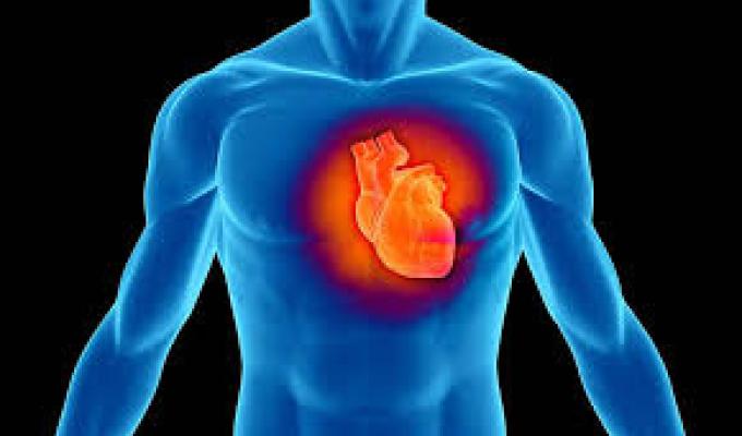 Яка медична допомога надається внутрішньо переміщеній особі при інфаркті