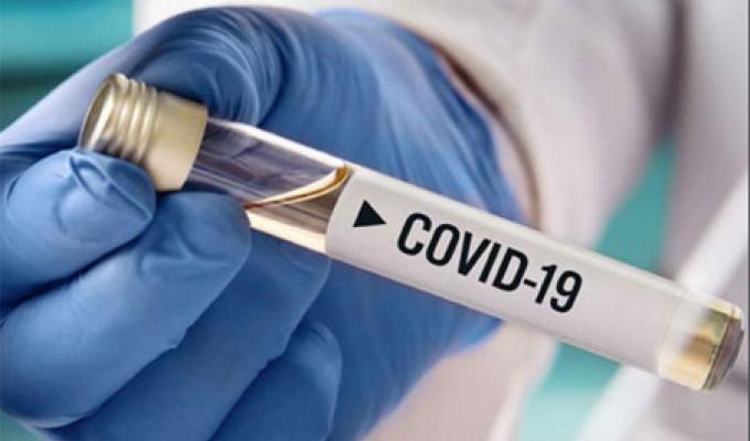 Лабораторно підтверджено 72 нових випадки COVID-19 в області