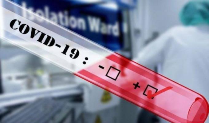 Лабораторно підтверджено 232 нових випадки COVID-19 в області