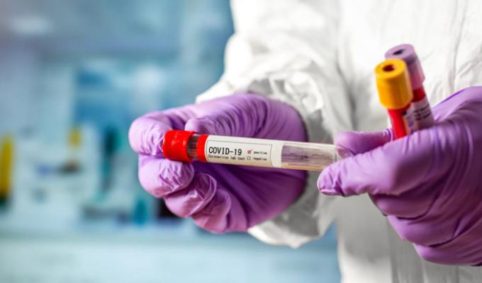 Шість нових випадків COVID-19 зафіксовано у Луганській області 