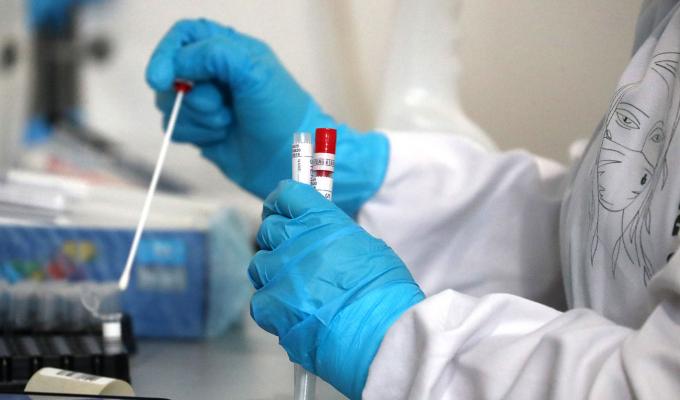 Лабораторно підтверджено 45 нових випадки COVID-19 в області 