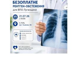 У Києві Кремінський медцентр організує рентген-діагностику та експрес-тестування для ВПО