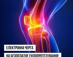 Послуга з ендопротезування є безоплатною для пацієнта