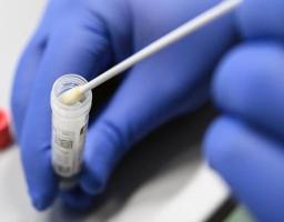 Лабораторно підтверджено 748 нових випадків COVID-19 за минулу добу в області. Із них у Сєвєродонецьку – 241