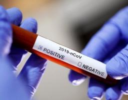 Лабораторно підтверджено 226 нових випадків COVID-19 в області. Від ускладнень померли ще шестеро хворих