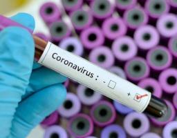 На Луганщині зафіксовано 44 нові випадки COVID-19. В Україні черговий антирекорд – 3 833 за добу