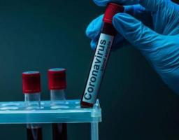 За добу в області зафіксовано 181 новий випадок COVID-19