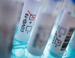 Лабораторно підтверджено один новий випадок COVID-19 в області 