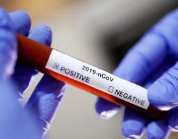 Лабораторно підтверджено 184 нових випадки COVID-19 в області. Від ускладнень померли ще три людини