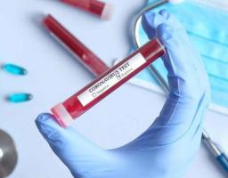 В області черговий антирекорд: за минулу добу зафіксовано 80 випадків COVID-19 