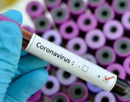 Лабораторно підтверджений 167 нових випадків COVID-19 в області. В Україні – ще 17 424