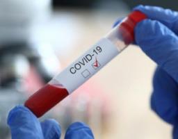 На Луганщині лабораторно підтверджено 12 нових випадків COVID-19 