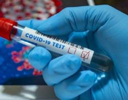 Зафіксовано 33 нові випадки COVID-19 за добу в області