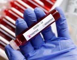 Лабораторно підтверджено 52 нових випадки COVID-19 в області. Від ускладнень померли чотири людини. В Україні – 231