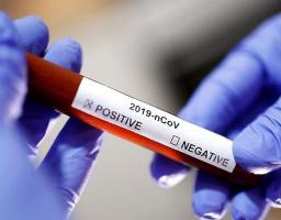 На Луганщині підтверджено ще один випадок захворювання на COVID-19.