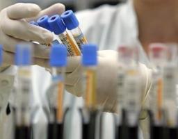 Лабораторно підтверджено 28 нових випадків COVID-19 на Луганщині за минулу добу