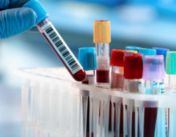 Лабораторно підтверджено 121 новий випадок COVID-19 в області за минулу добу. Від ускладнень померло ще восьмеро хворих