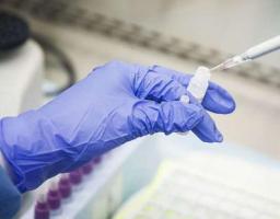 Лабораторно підтверджено 107 нових випадків COVID-19 в області за минулу добу. Від ускладнень померли ще 13 хворих