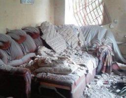 Юрій Гарбуз: Постраждала внаслідок обстрілу жінка знаходиться в реанімації