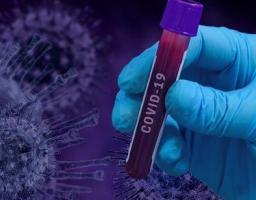 За минулу добу нових захворювань на COVID-19 в області не зафіксовано