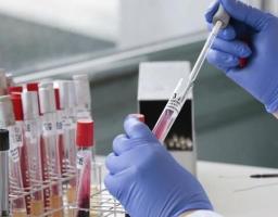 Лабораторно підтверджено 229 нових випадків COVID-19 на Луганщині за минулу добу. Від ускладнень померло ще 14 хворих