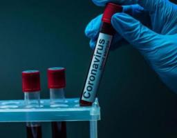 Лабораторно підтверджено 28 нових випадків COVID-19 в області