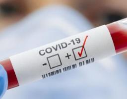 На Луганщині зафіксовано один новий випадок захворювання на COVID-19. Три особи одужали