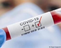 Лабораторно підтверджено один новий випадок COVID-19 в області