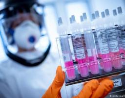 Лабораторно підтверджено 20 нових випадків COVID-19 в області. Від ускладнень померло троє хворих