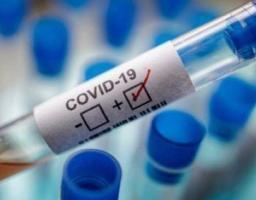 В області зафіксовано шість нових випадків захворювання на COVID-19