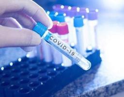 На Луганщині лабораторно підтверджено 91 новий випадок COVID-19 