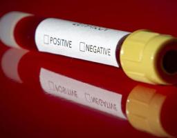 На Луганщині за добу лабораторно підтверджено 52 нових випадки COVID-19