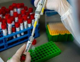 За минулу добу в області підтверджений один новий випадок захворювання на COVID-19. Три людини одужали