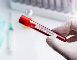 На Луганщині підтверджений новий випадок захворювання на COVID-19