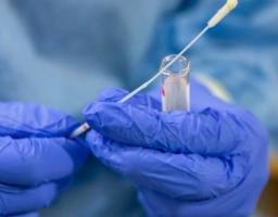 Лабораторно підтверджено один новий випадок COVID-19 в області за минулу добу