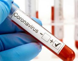 В області за добу лабораторно підтверджено 107 нових випадків COVID-19. Від ускладнень померли ще шість людей