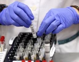 Лабораторно підтверджено 55 нових випадків COVID-19 в області за минулу добу. Від ускладнень померло ще семеро хворих